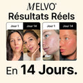Baume Suif & Miel MELVO Éclat Pur